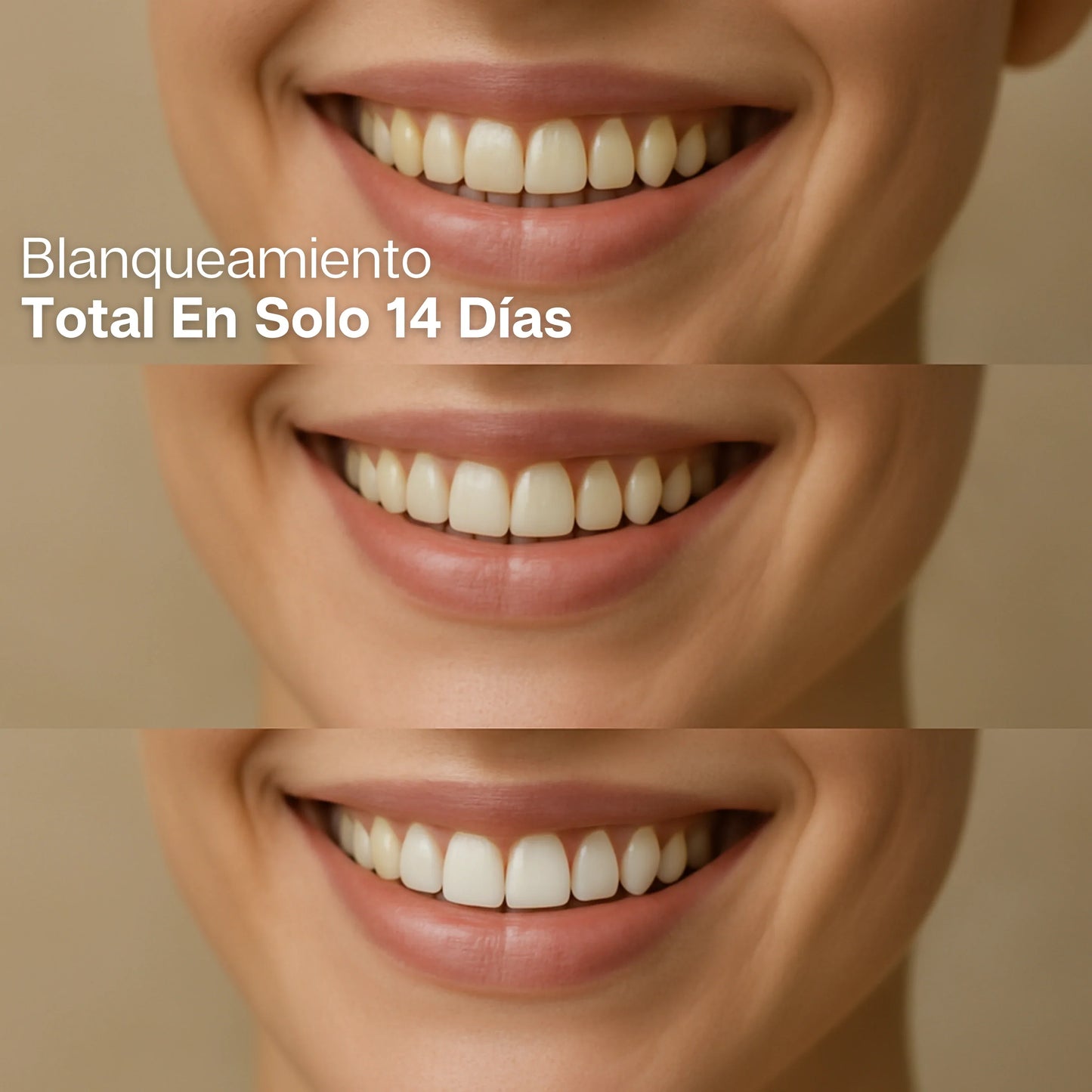 😁 Tiras Blanqueadoras Dentales + ENVÍO GRATIS