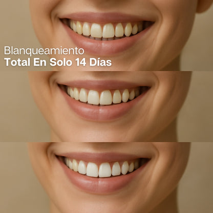 😁 Tiras Blanqueadoras Dentales + ENVÍO GRATIS